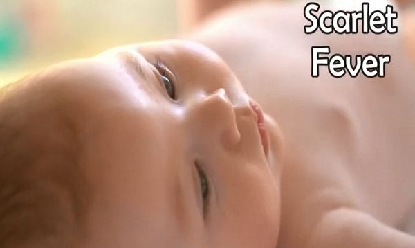 Scarlet Fever Symptoms, Treatment, and Causes