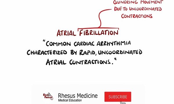 Atrial Fibrillation Made Easy