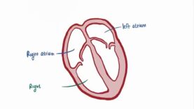 Atrial fibrillation A fib, AF causes, symptoms, treatment pathology