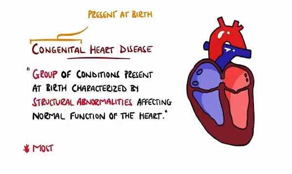 Congenital Heart Malformations Made Easy (8 Main Types)
