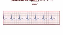 Electrocardiography (ECG_EKG) – basics