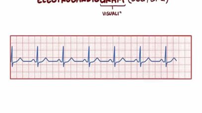 Electrocardiography (ECG_EKG) – basics