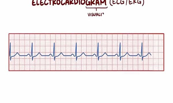 Electrocardiography (ECG_EKG) – basics