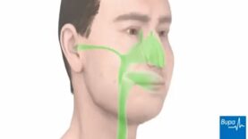 How a common cold develops