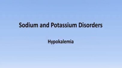 Hypokalemia