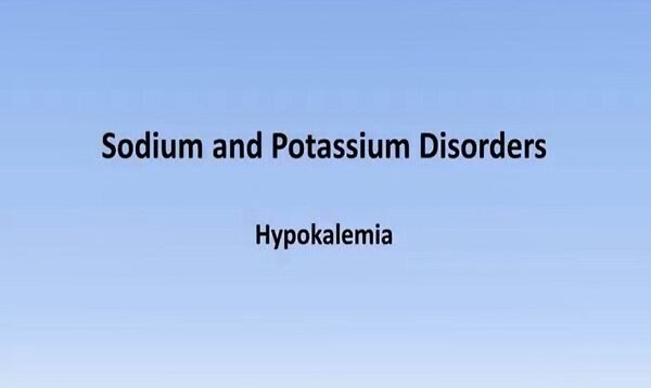 Hypokalemia