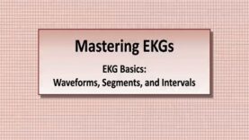 Intro to EKG Interpretation Waveforms, Segments, and Intervals