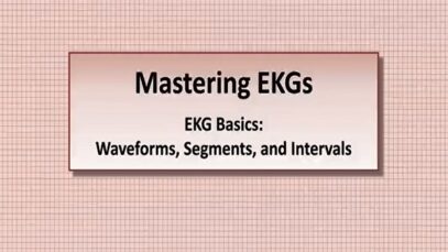 Intro to EKG Interpretation Waveforms, Segments, and Intervals