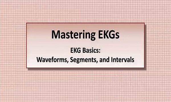 Intro to EKG Interpretation Waveforms, Segments, and Intervals