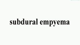Understanding Subdural Hematoma