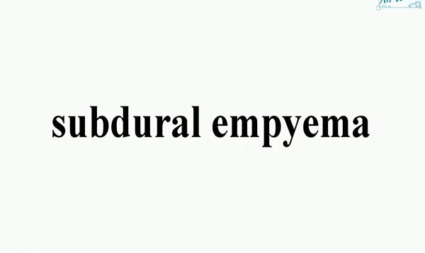 Understanding Subdural Hematoma