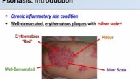 Overview of Psoriasis-What Causes ItWhat Makes It Worse.