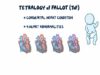 Tetralogy of Fallot