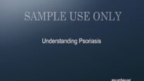 Understanding Psoriasis