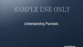 Understanding Psoriasis
