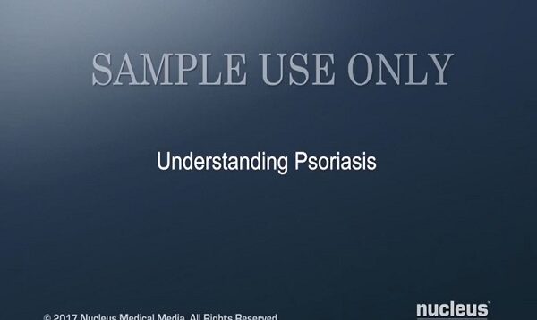 Understanding Psoriasis