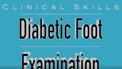 Diabetic Foot Examination – Clinical Skills