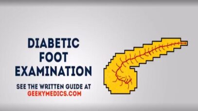Diabetic foot examination OSCE guide
