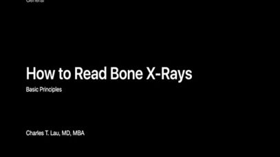 How Do X-rays Work