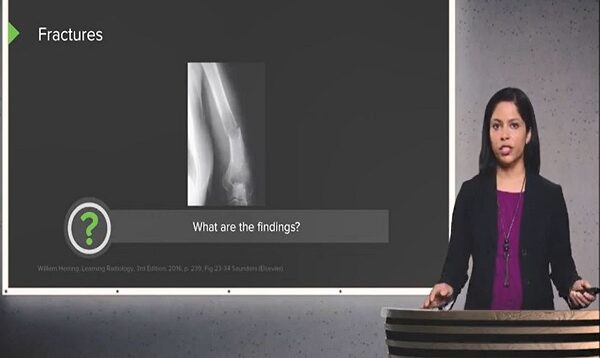 Imaging of Bones Fractures, Bony Anatomy and Bony Density–Radiology