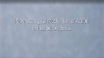 Psoriatic Arthritis