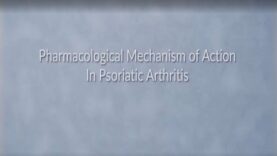 Psoriatic Arthritis