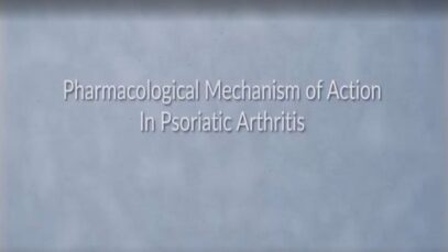 Psoriatic Arthritis