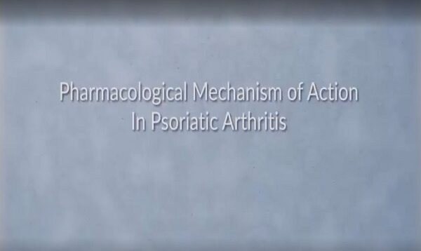 Psoriatic Arthritis