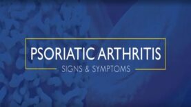 Psoriatic Arthritis Signs and Symptoms