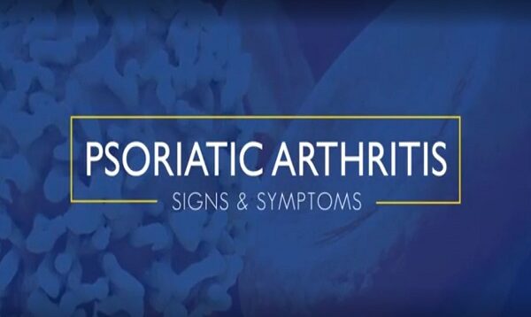 Psoriatic Arthritis Signs and Symptoms
