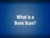 Understanding Radiology_ What is a Bone Scan_