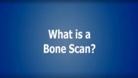 Understanding Radiology_ What is a Bone Scan_