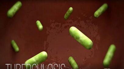 cdc tuberculosis tb transmission and pathogenesis