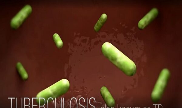 cdc tuberculosis tb transmission and pathogenesis