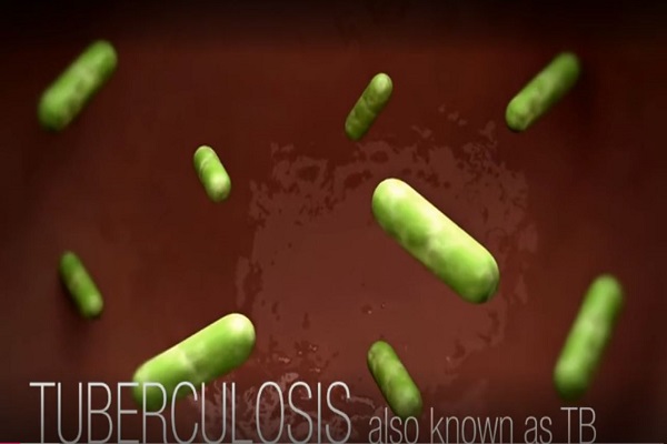 cdc tuberculosis tb transmission and pathogenesis