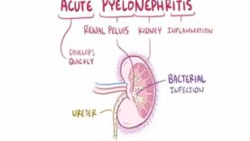 Acute pyelonephritis urinary tract infection causes, symptom