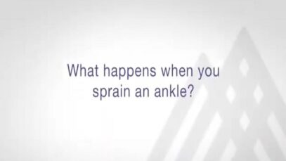 How to Care for a Sprained Ankle