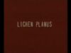 Lichen Planus
