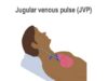 Measuring the jugular venous pulse
