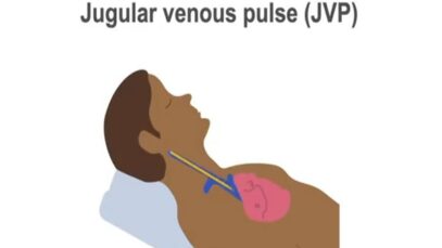 Measuring the jugular venous pulse