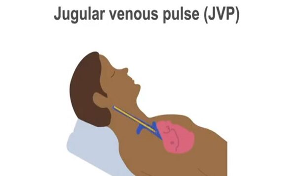 Measuring the jugular venous pulse