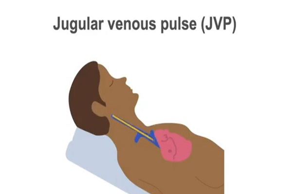Measuring the jugular venous pulse