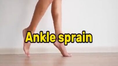 Sprained Ankle. Best Way To Avoid Chronic Issues