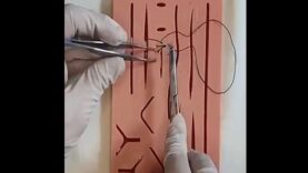 Surgeon’s Knot Continuous Suturing Aberdeen Termination HD Demo