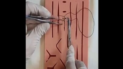 Surgeon’s Knot Continuous Suturing Aberdeen Termination HD Demo