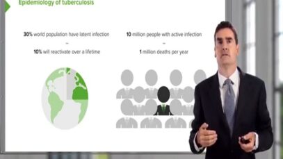 Tuberculosis Pathogenesis Diagnosis Treatment