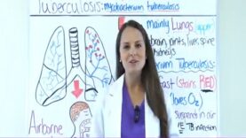 Tuberculosis TB Symptoms, Treatment, Causes