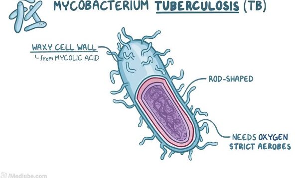 Tuberculosis causes, symptoms, diagnosis, treatment, pathology