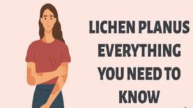 Unlocking the Mystery of Lichen Planus Everything You Need to