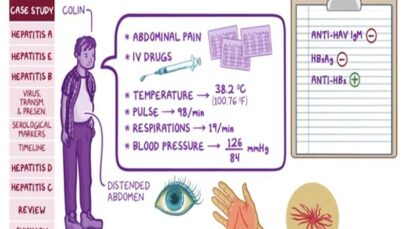 Viral hepatitis Pathology Review